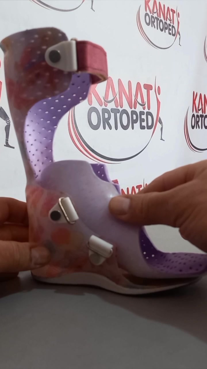 @KanatOrtopedi