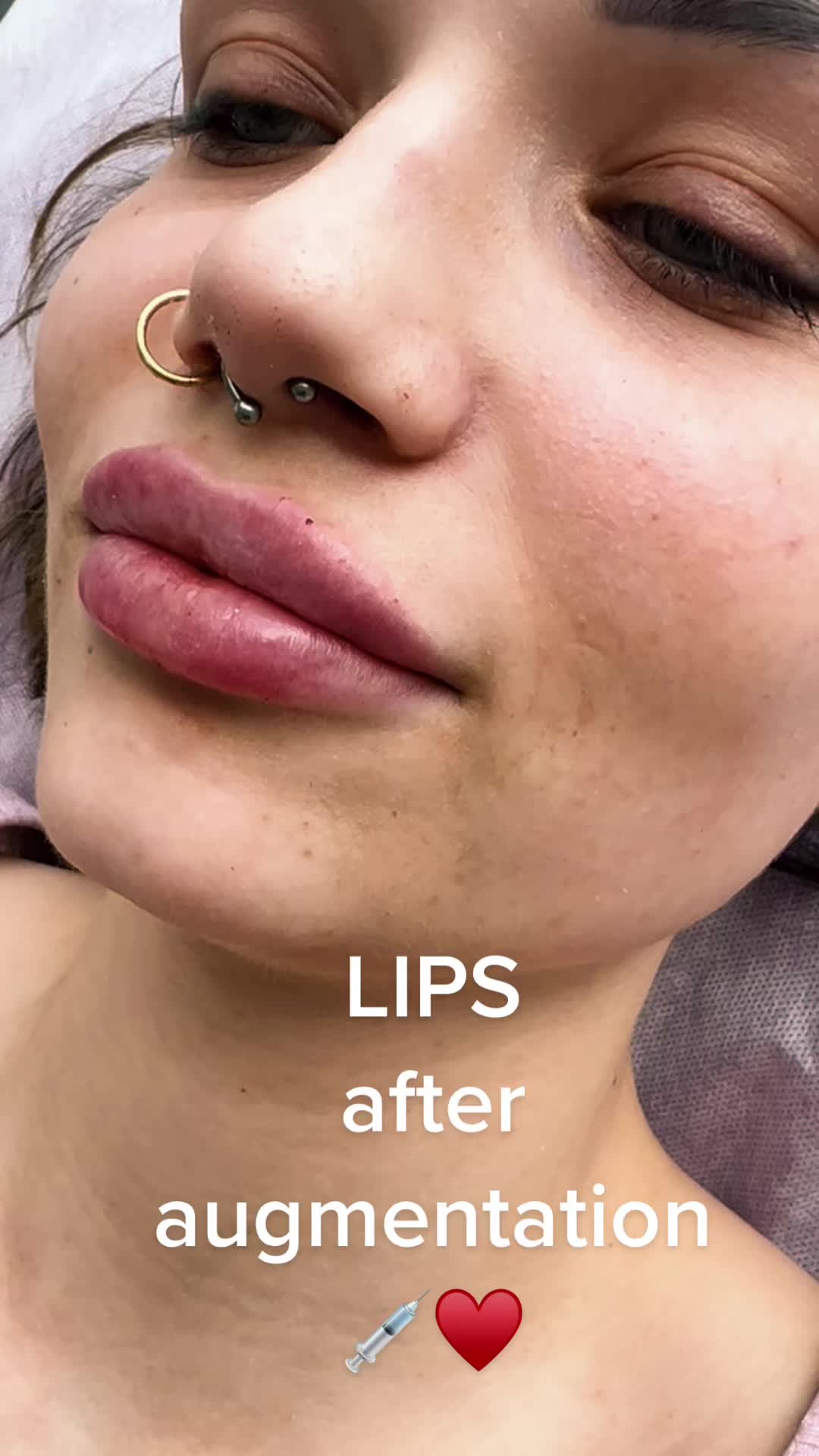 @Dr. Kira
