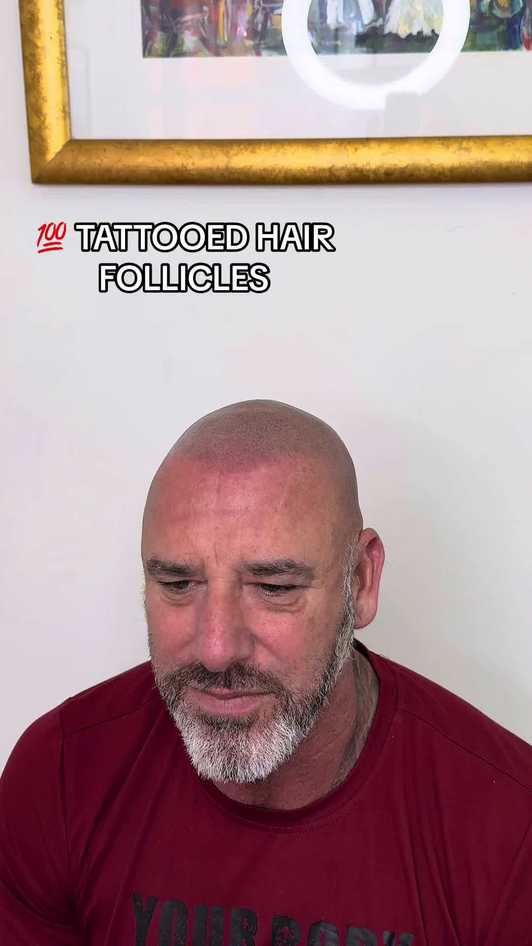 @naturalprosmp