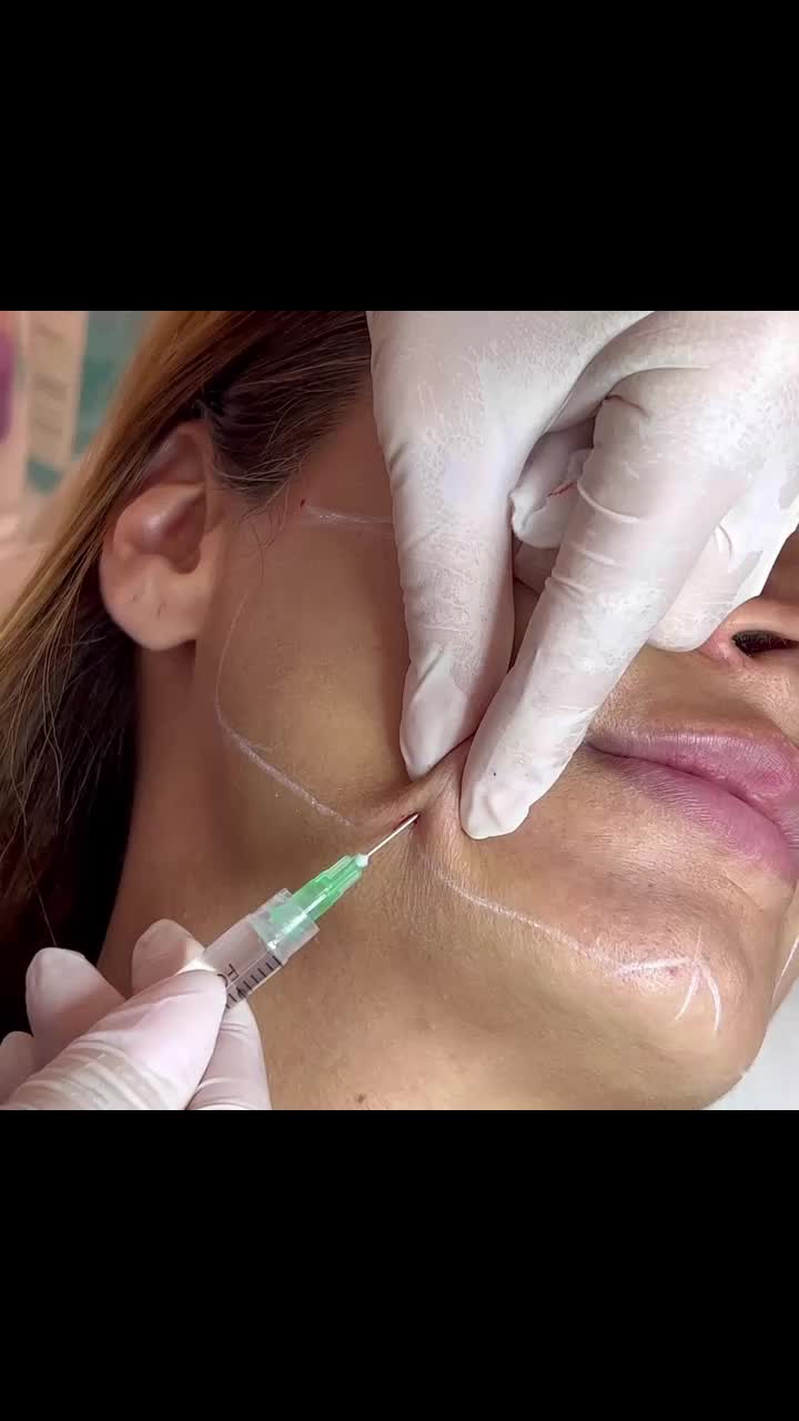 @Dr.kemale.nazarli Dermatoloq
