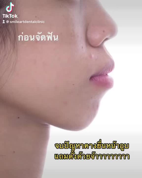 @smile Art Pattaya