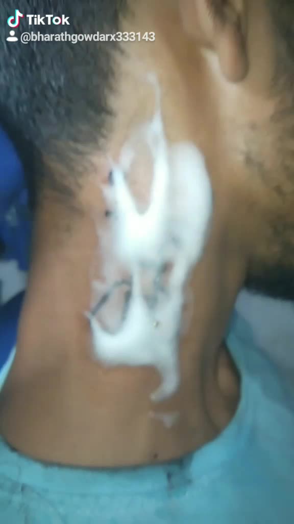 @Bharath Gowda Rx
