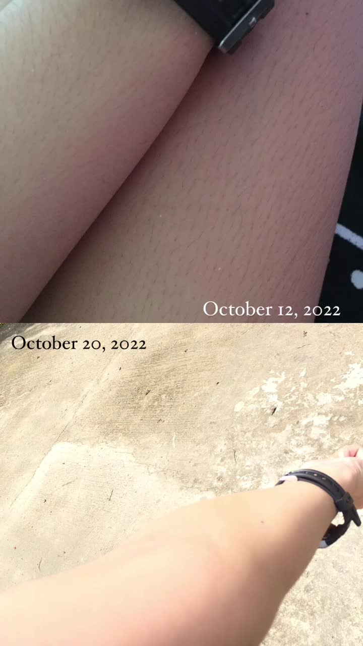 @F