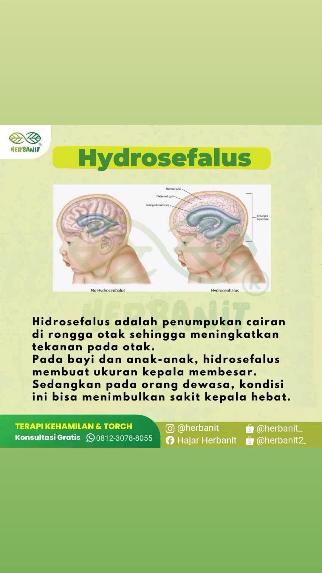@herbanit agen hajar