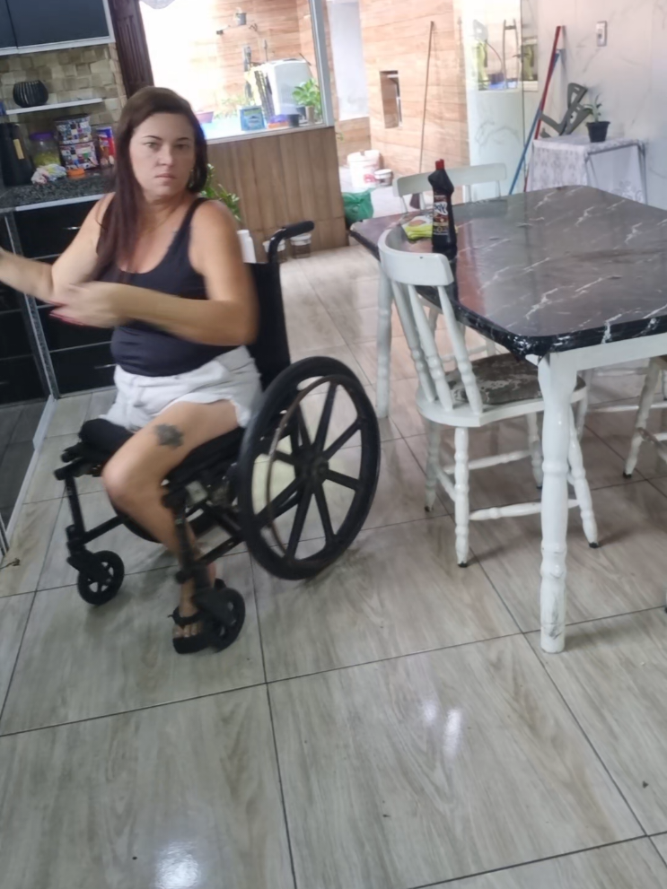 @Rotina de uma amputada 🦵🩼🩼