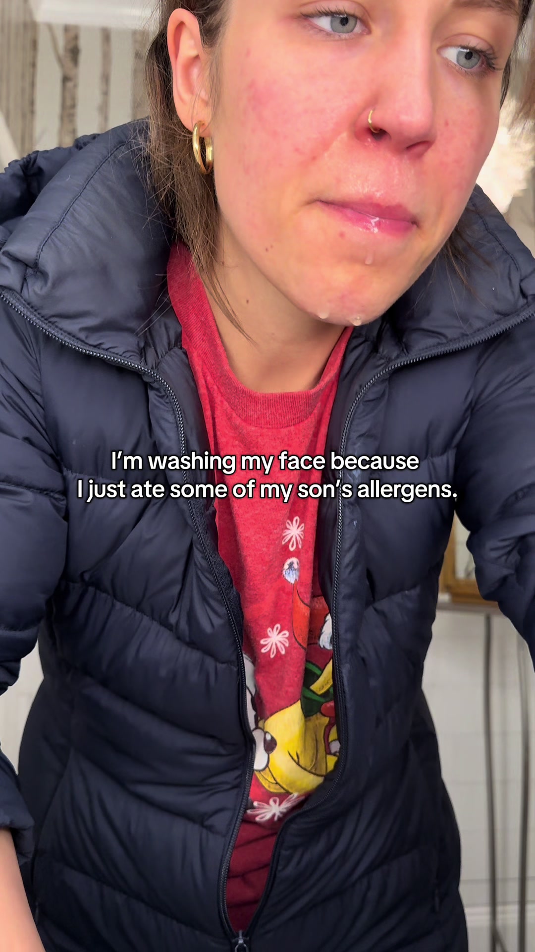 @Eczemama
