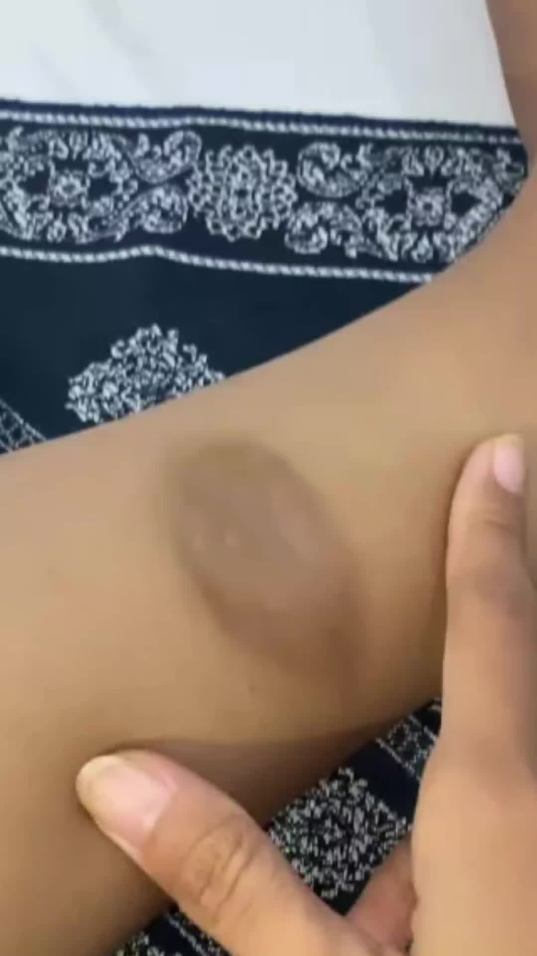 @Cirancana