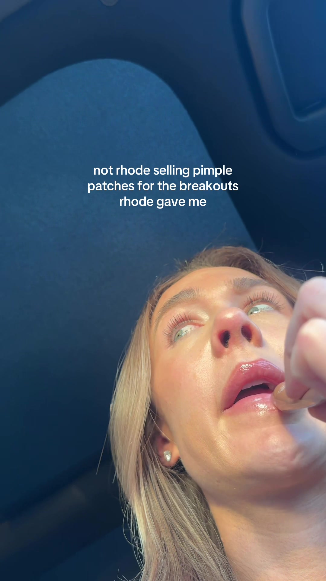 @Celeste | RN acne expert