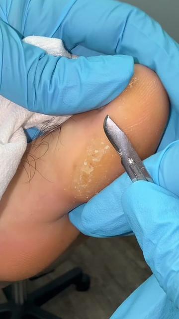 @Deniel Foot and Ankle Center