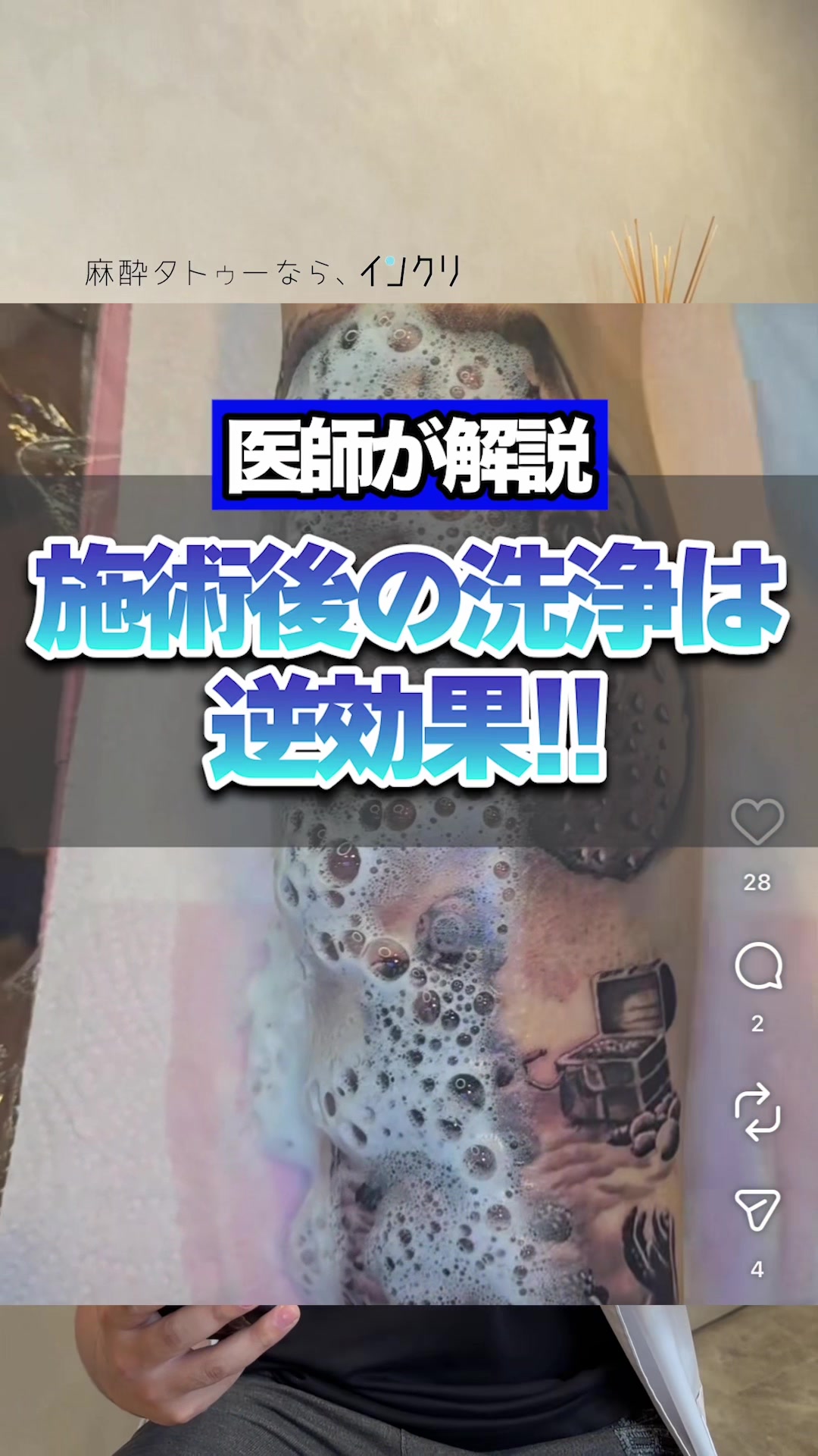 @麻酔タトゥーのインクリ