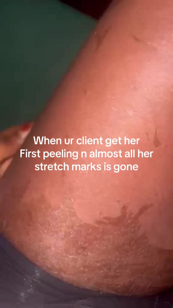 @@ Precious peeling soap