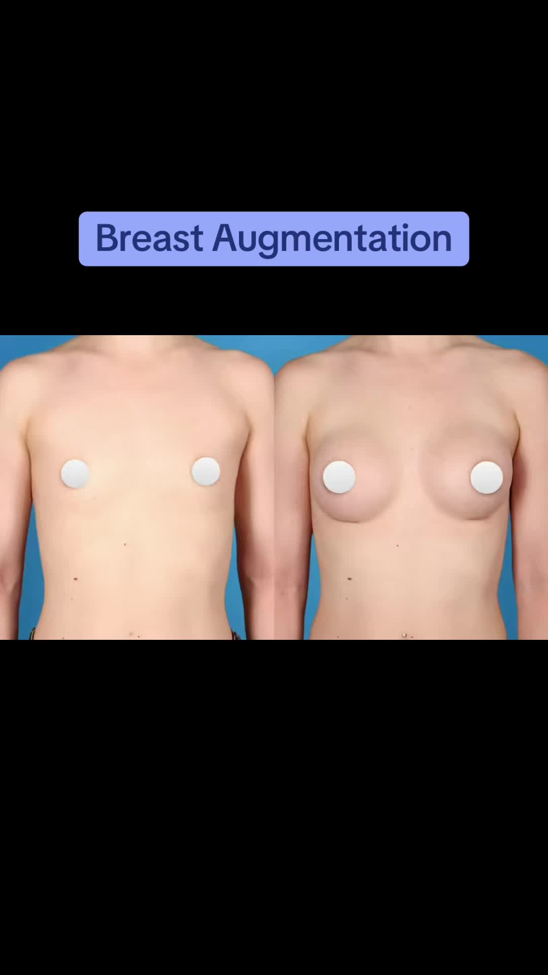 @Kelly Killeen, MD, FACS