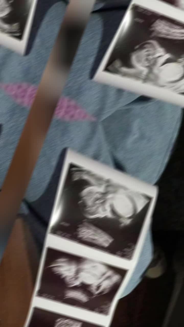 @Xococo09