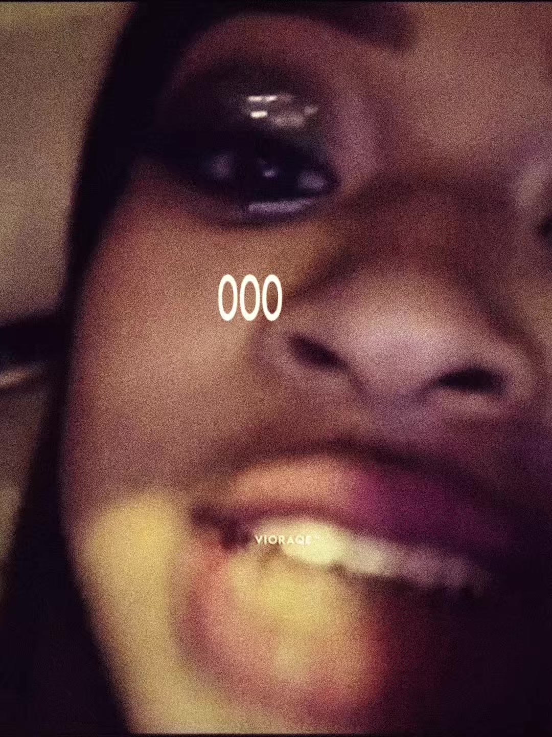 @⃟