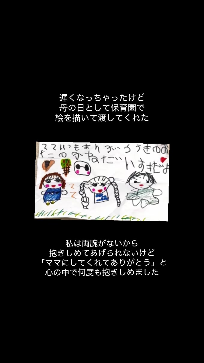 @佐野有美/講演家•四肢欠損ママ