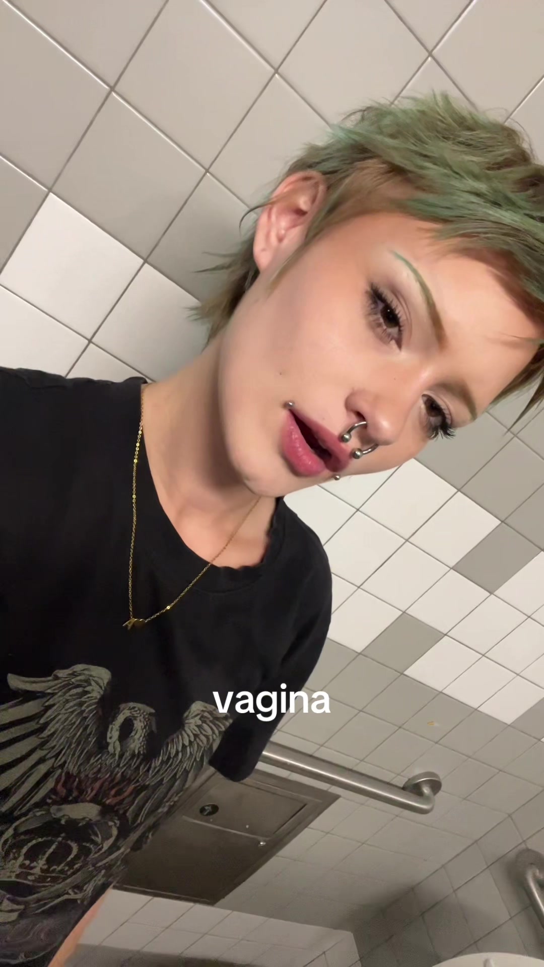@queef.infection