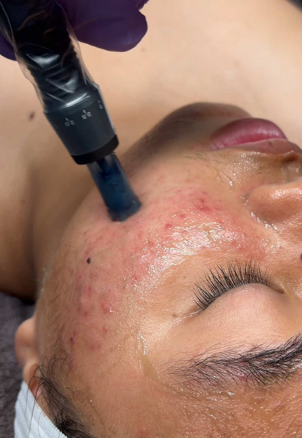 @Toronto Holistic Facialist