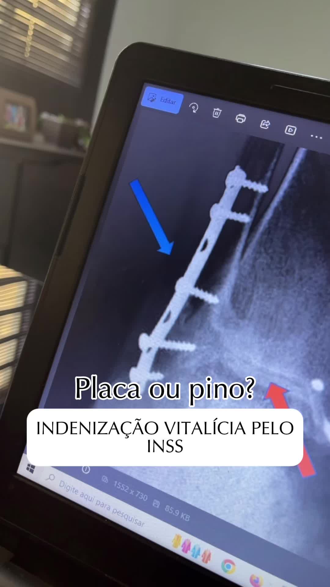 @Ana Paula Rolim| Advogada INSS