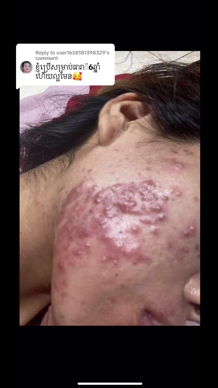 @សម្រស់ ធារ៉ា