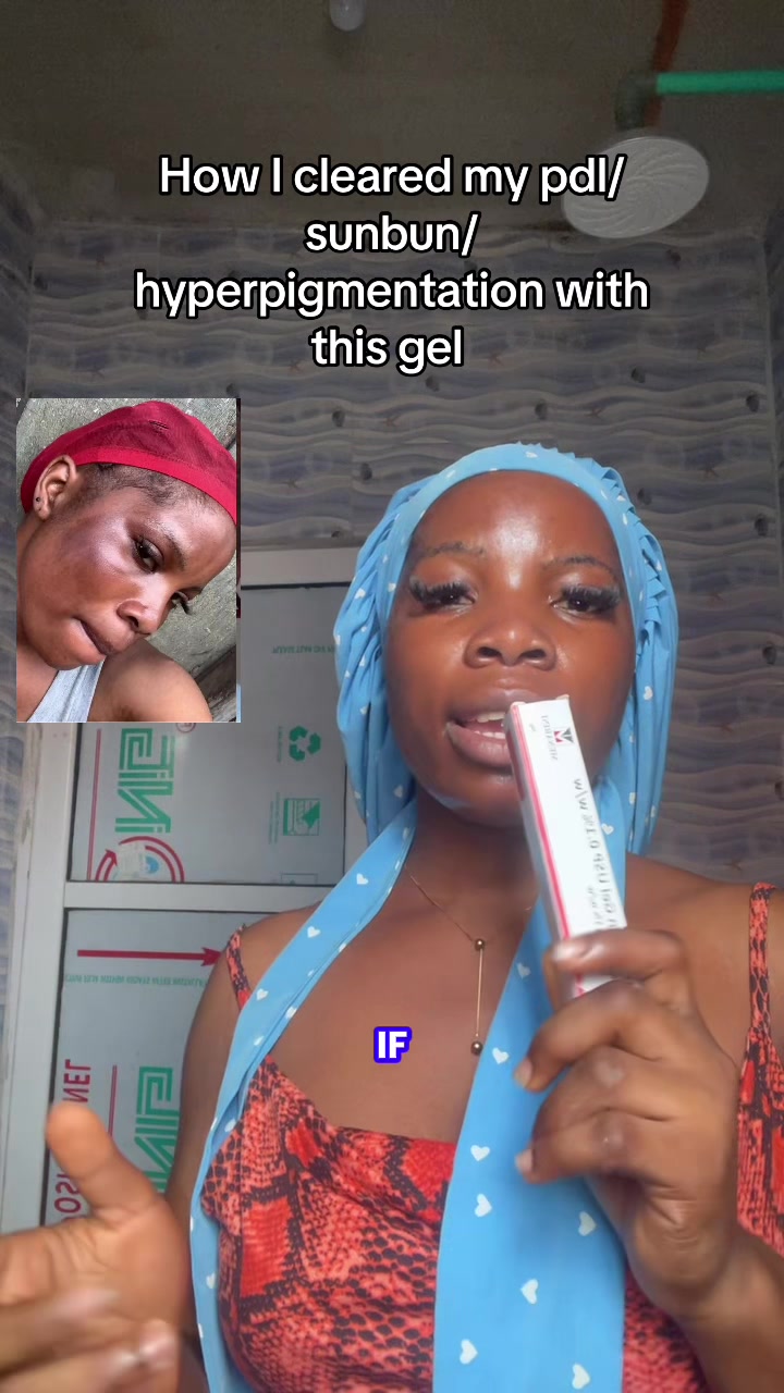 @꧁༆Kween Tolex🥹💕🦋🌸 ༆꧂