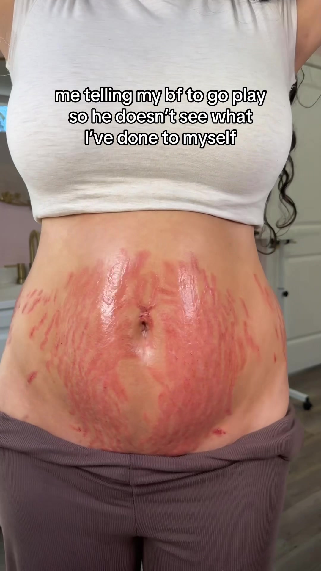 @Stretch Mark Fairy 🧚✨