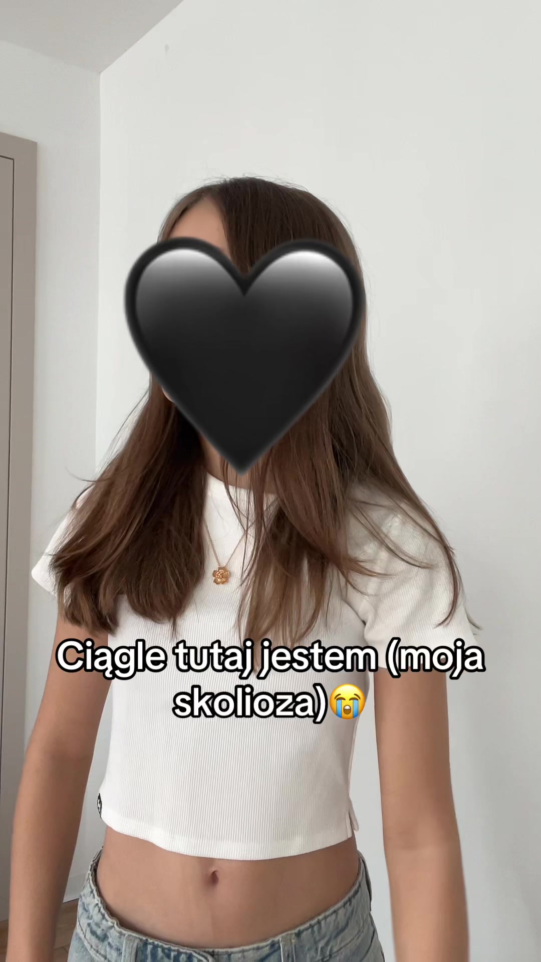 @Twin.withscoliosis🩻🪽💋