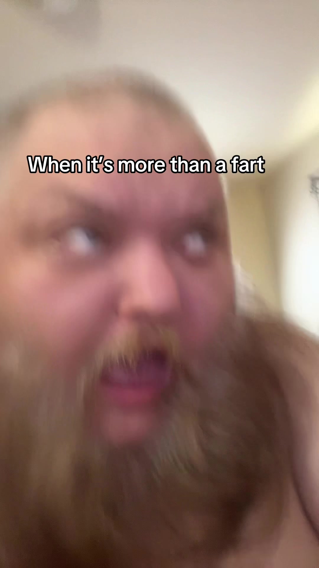 @KingBeardX