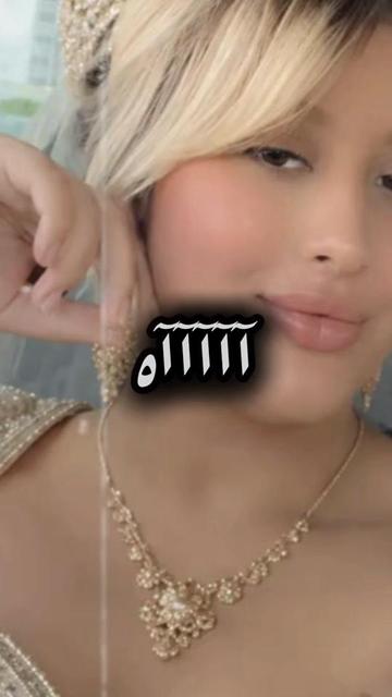 @MIRNA31