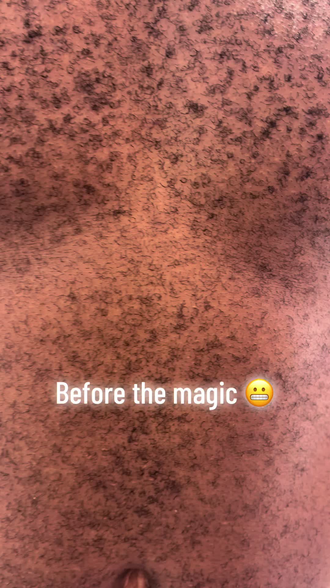 @snycfrisco