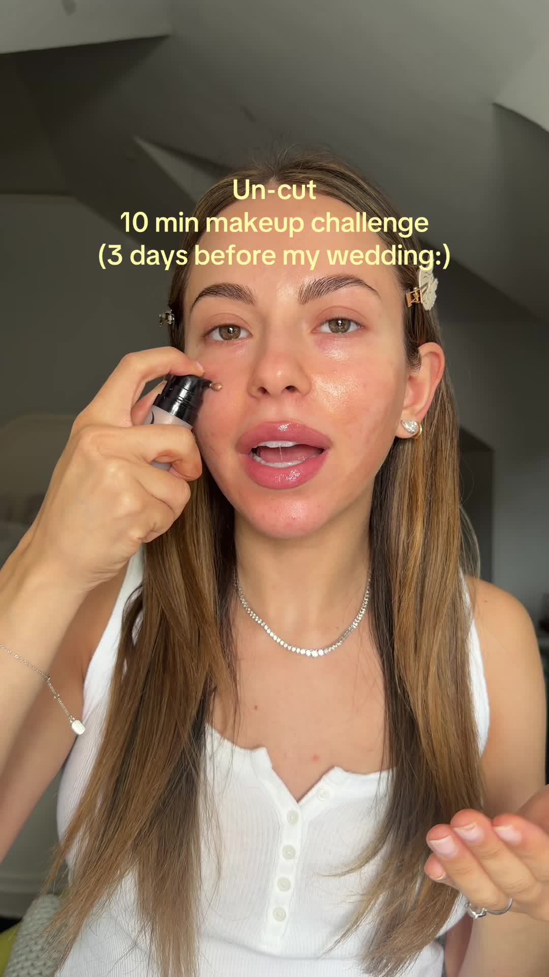 @Anya