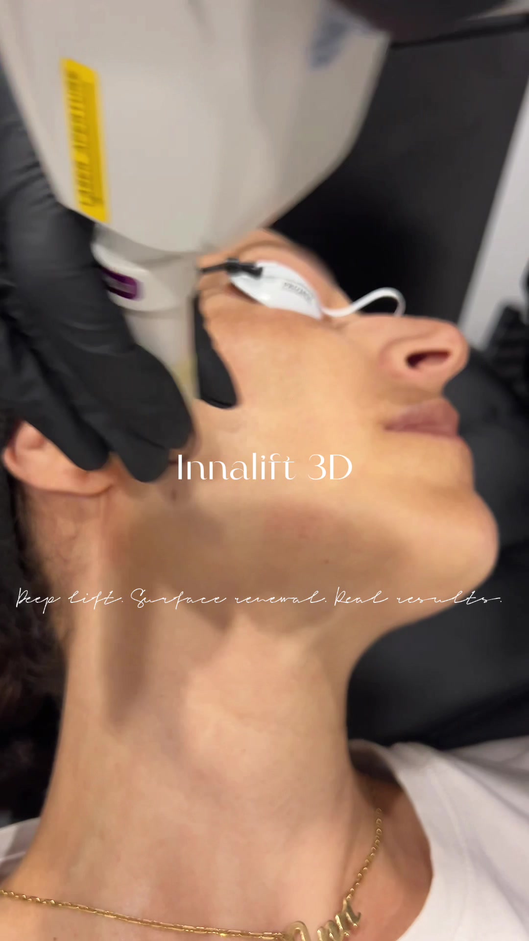 @InnaSkin Face Body