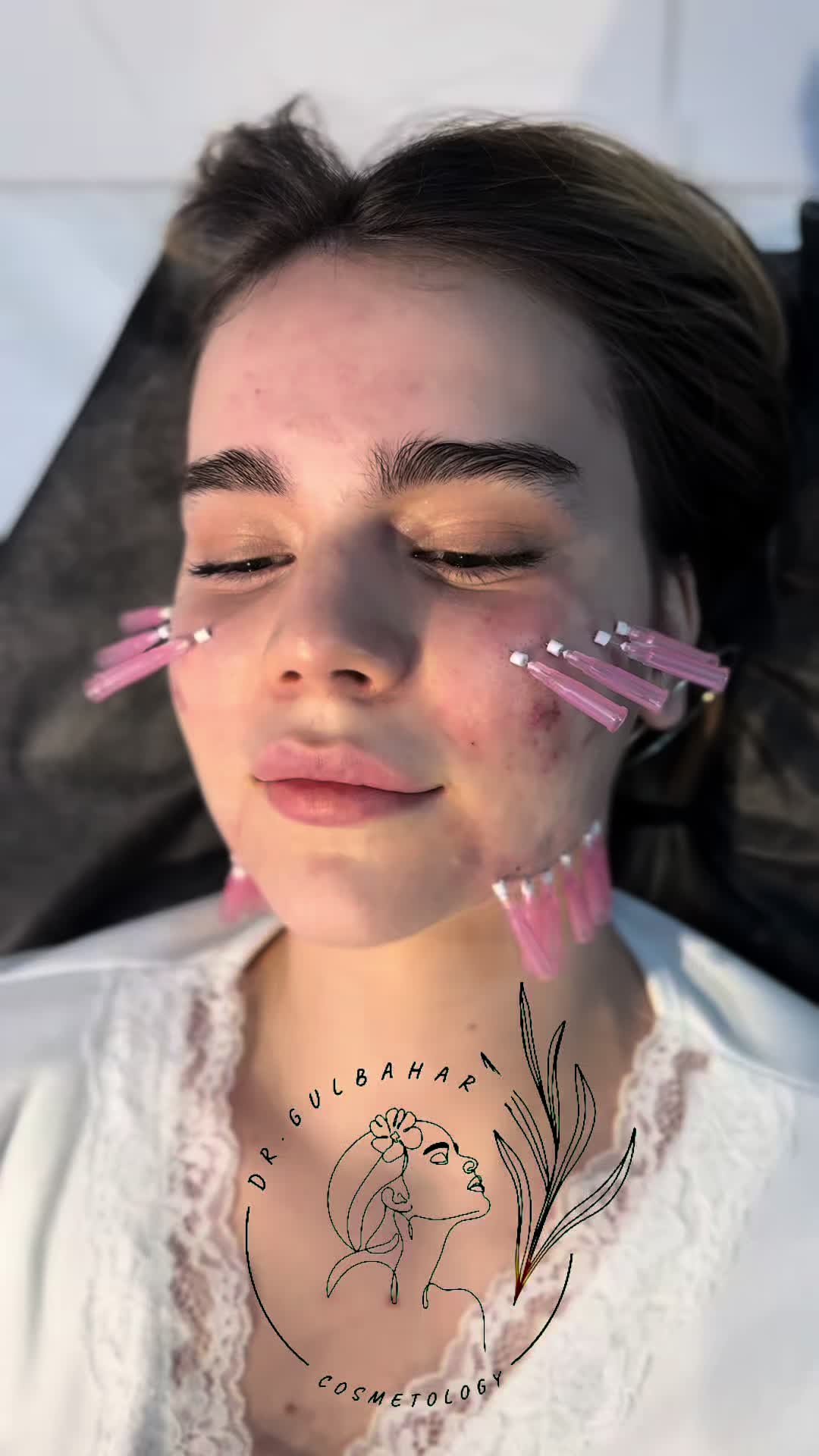 @Dr_Gülbahar_Cosmetolog