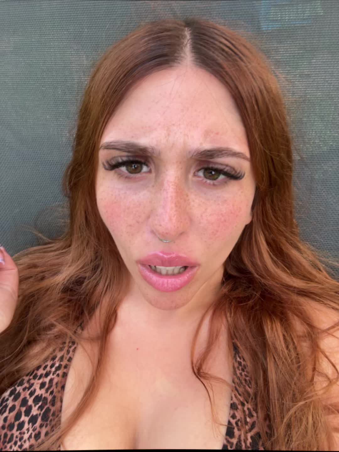 @ketoprophede