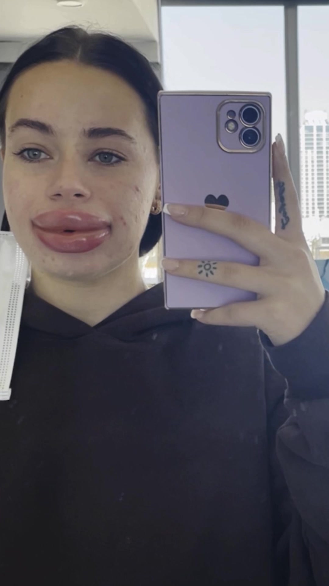 @tlc