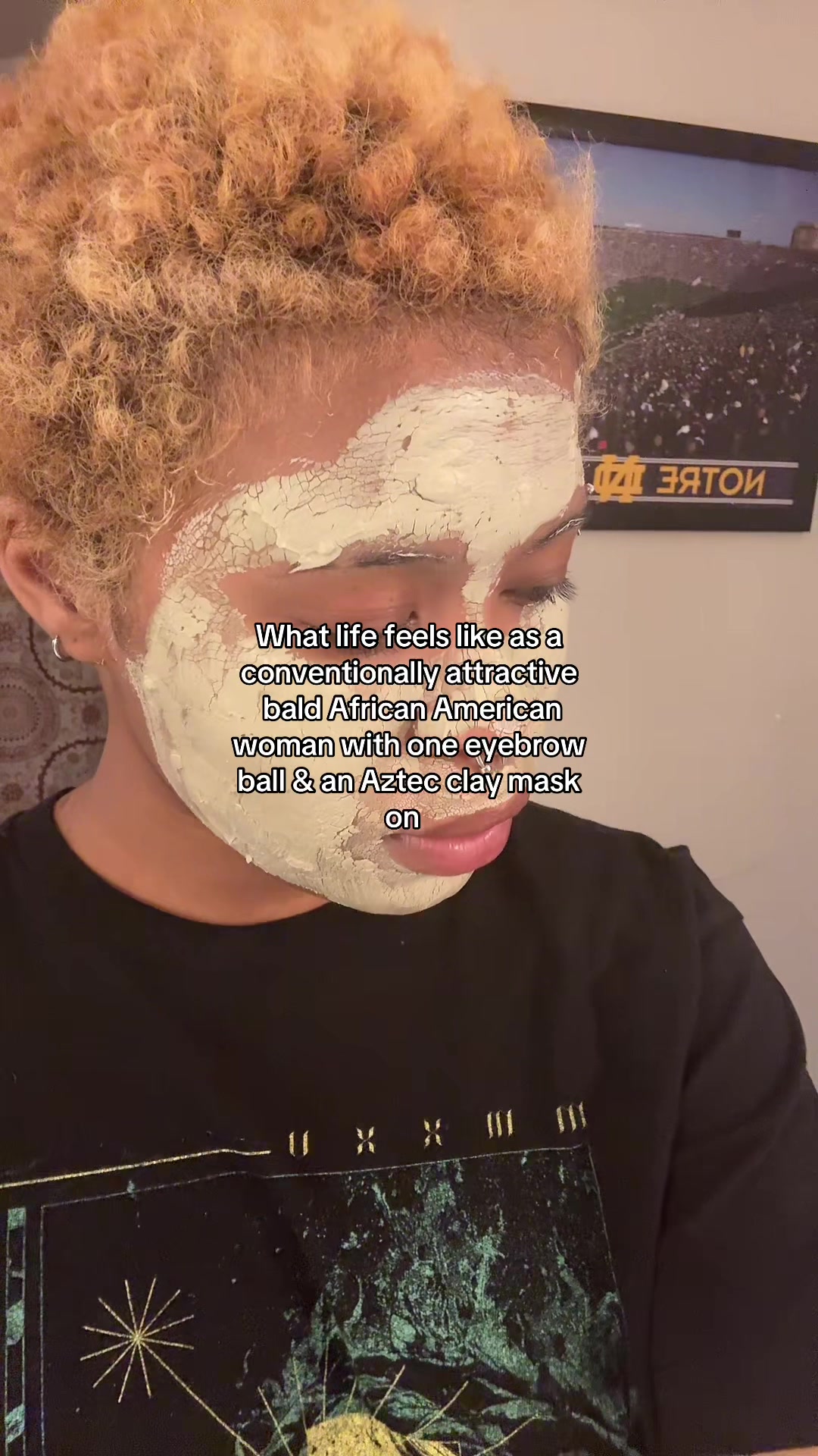 @bald bastard