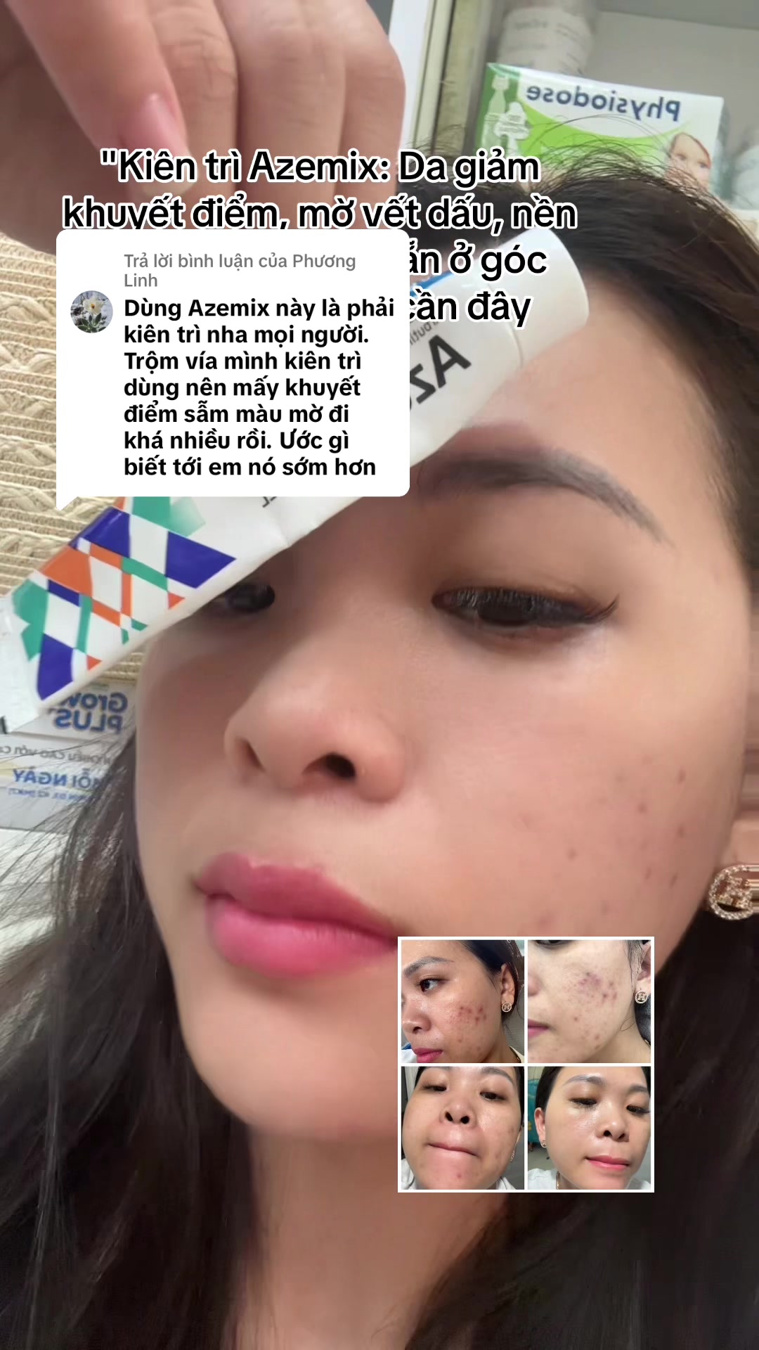 @Hoa Acne Skincare🌷