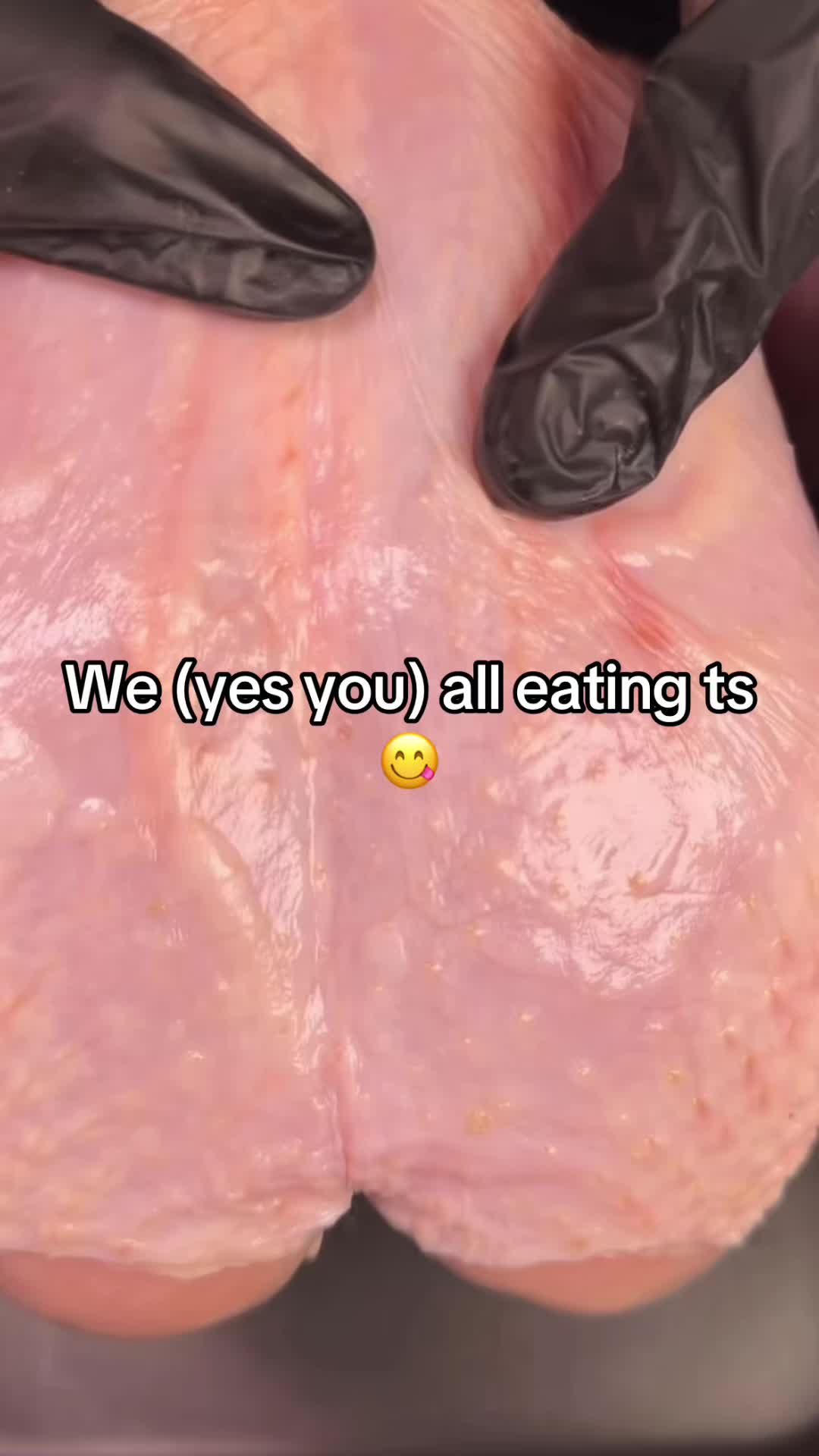 @Hxbitz