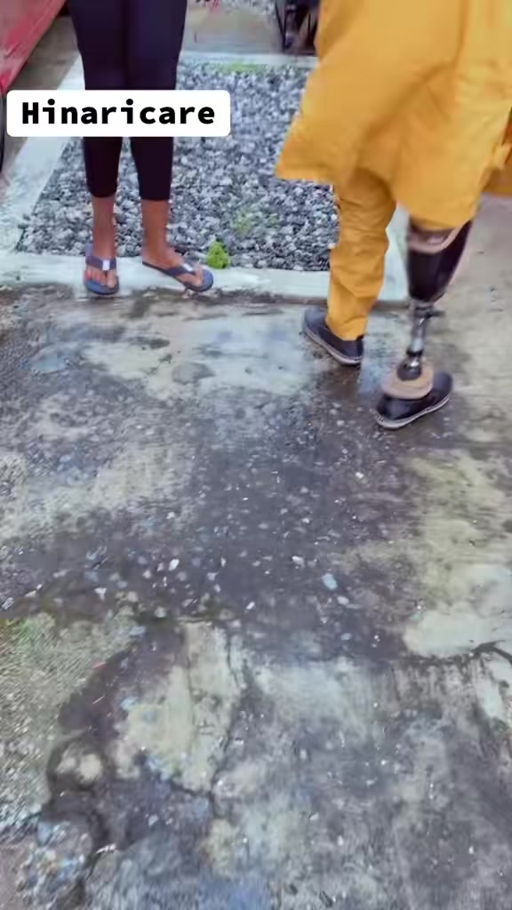 @Hinaricare prosthetics