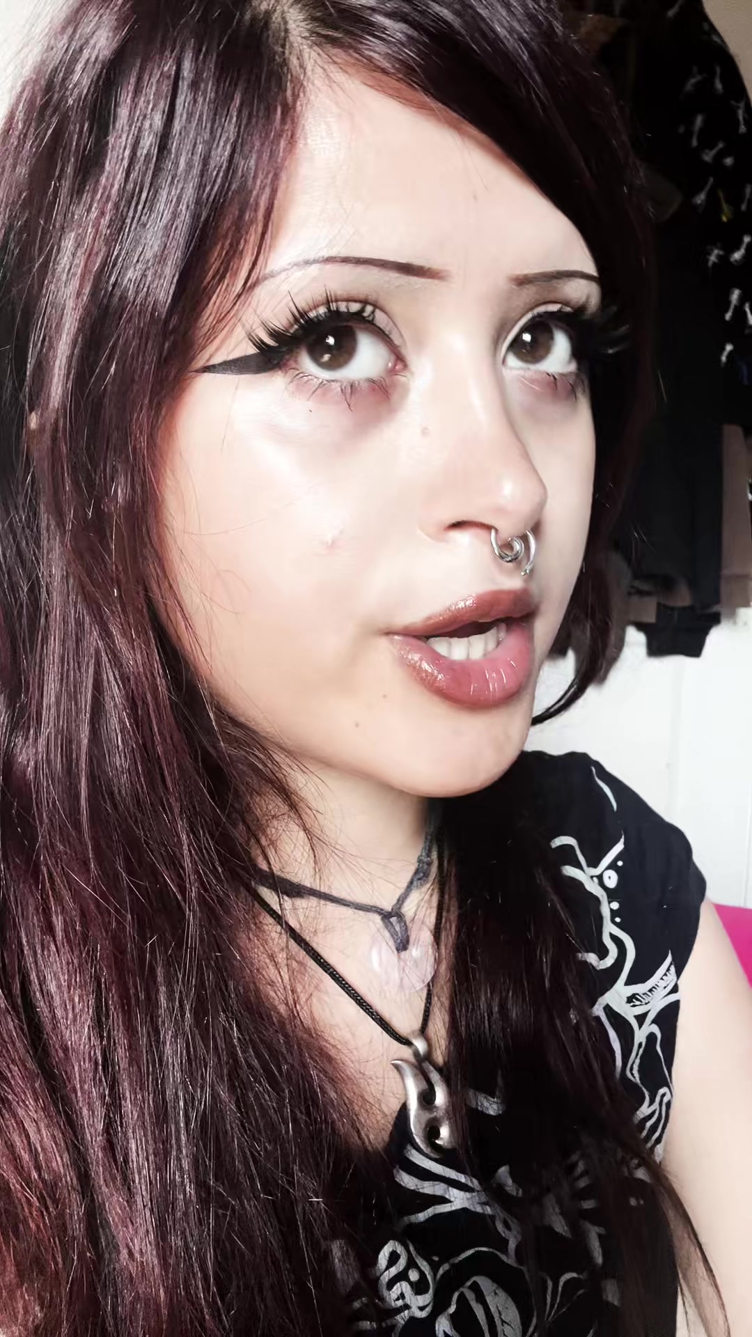 @L🩻