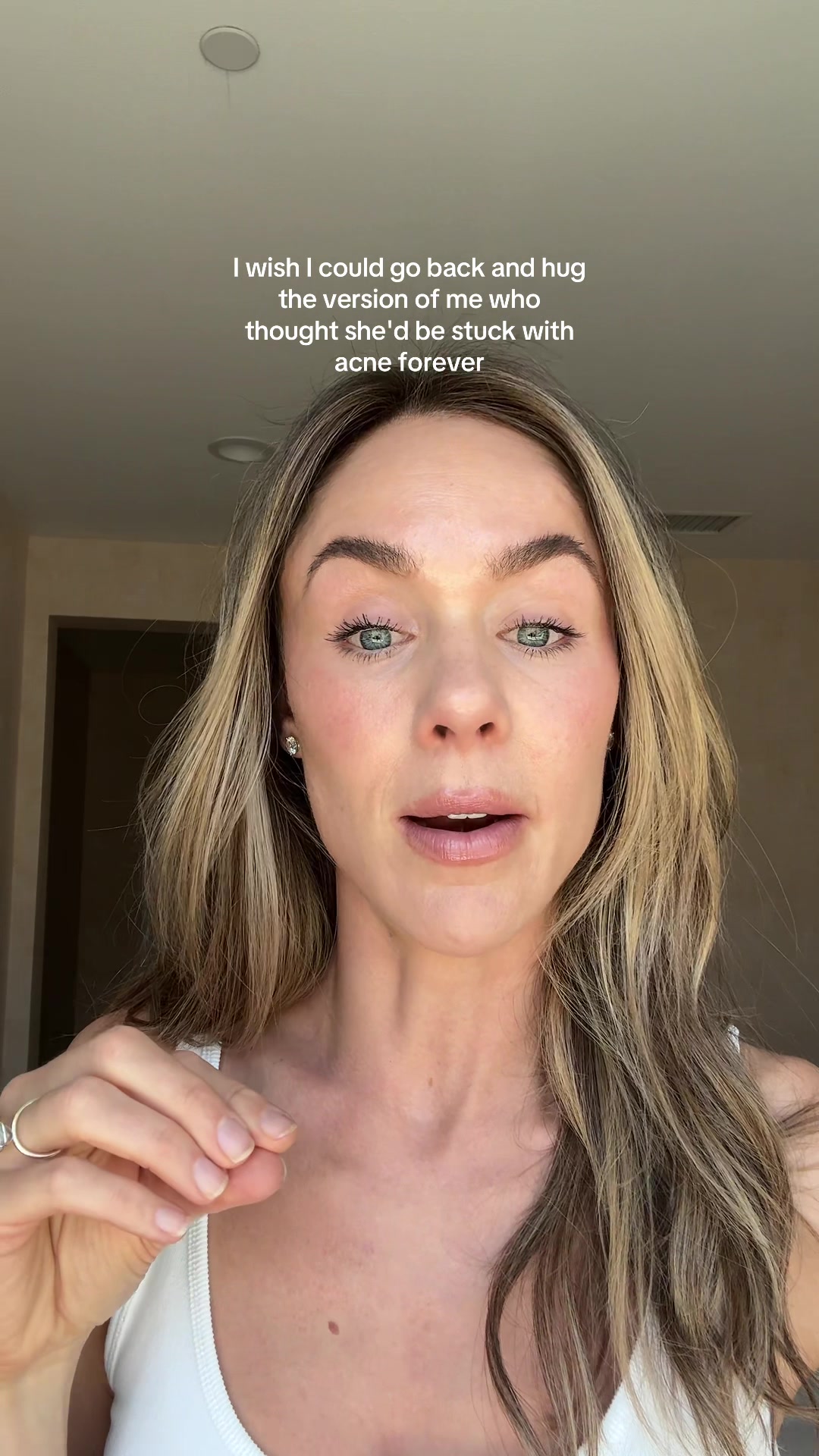@Celeste | RN acne expert