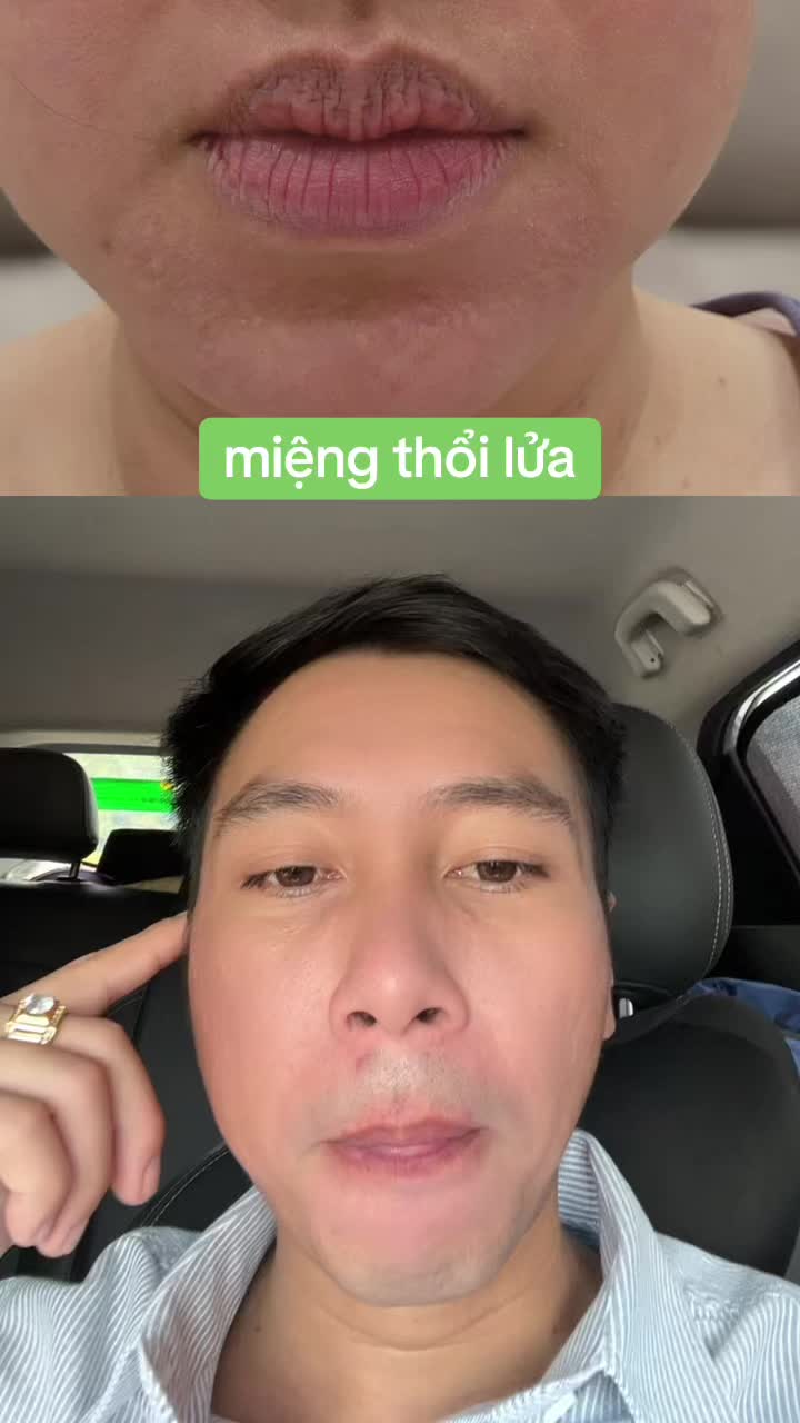@Tuệ Nhãn ✅