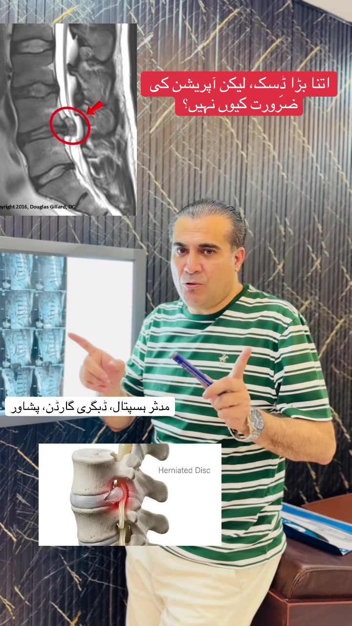 @ڈاکٹر مشتاق شمس نیورو سرجن