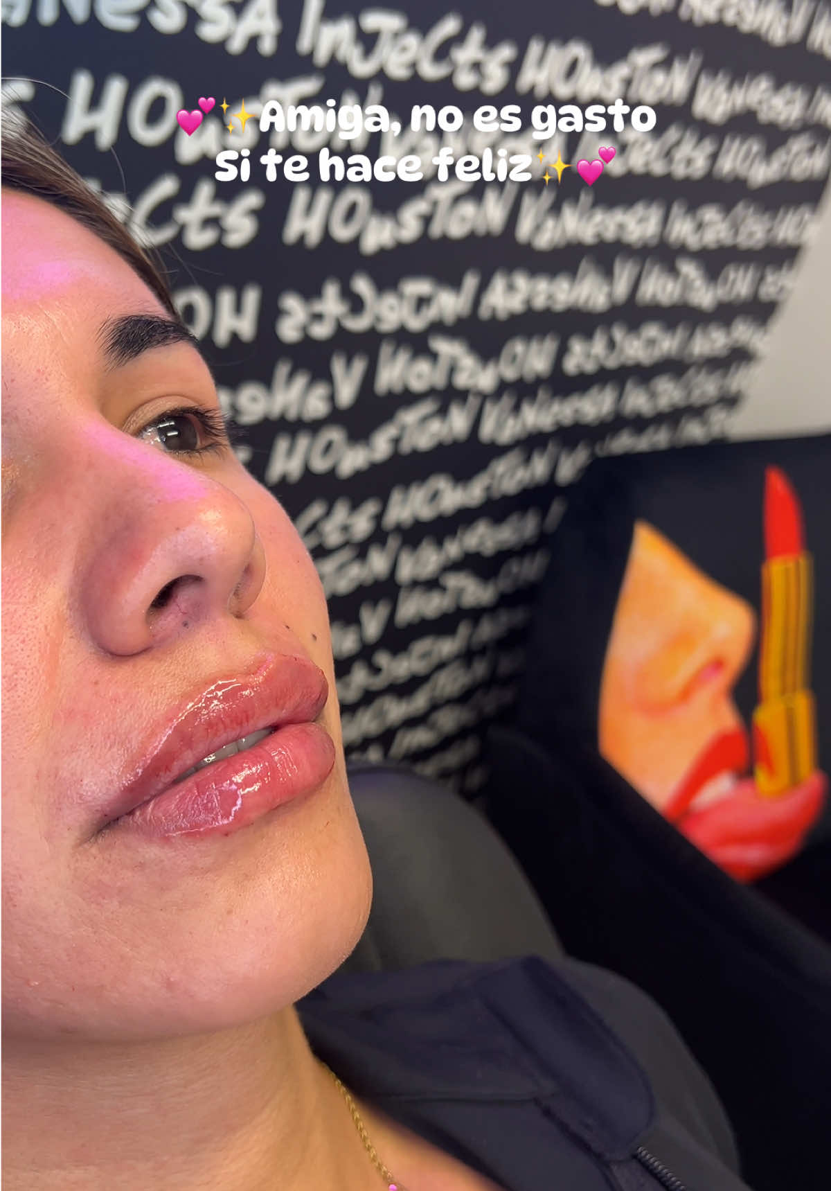 @Vanessa Injects