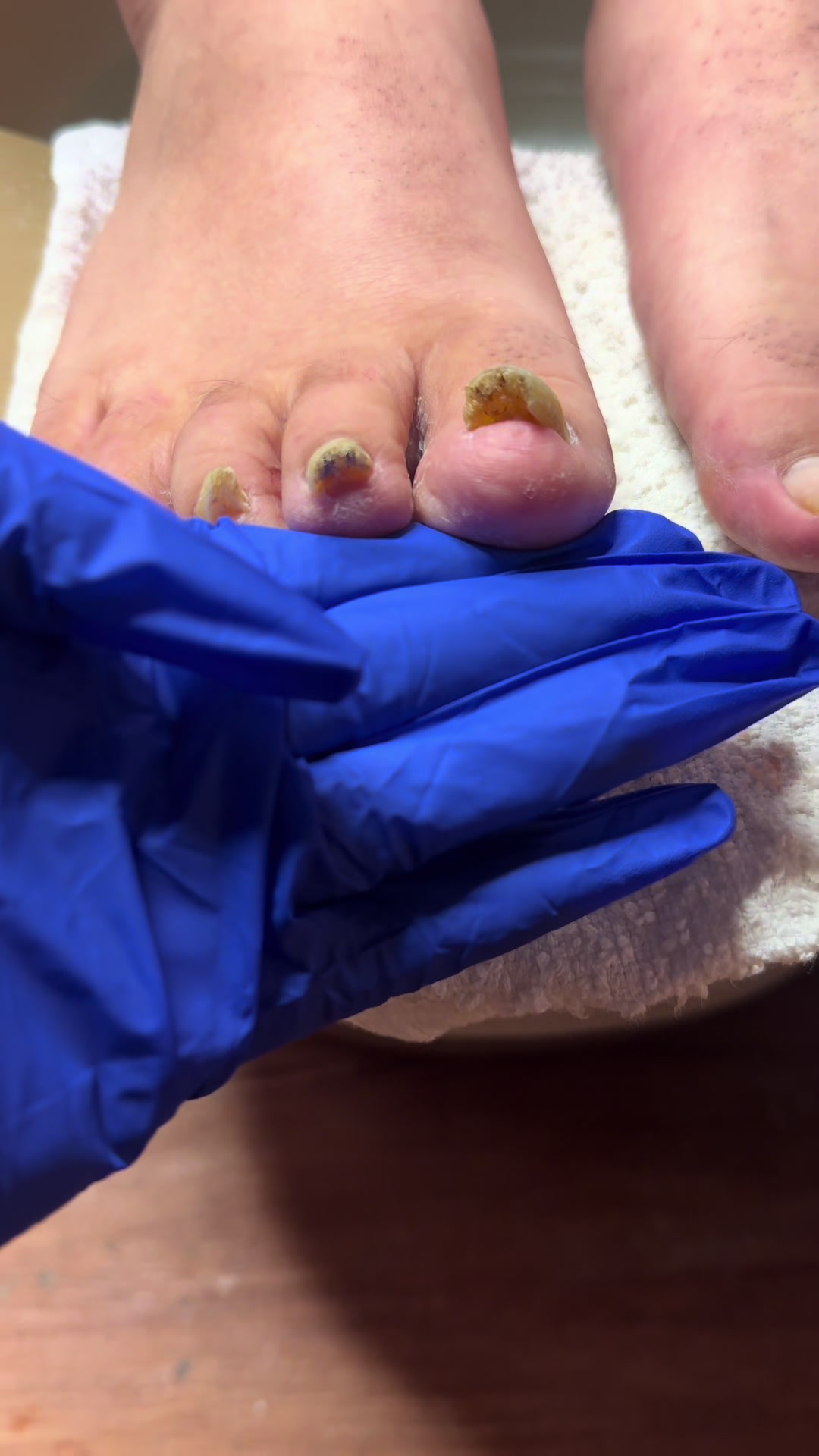 @ToesbyKoki
