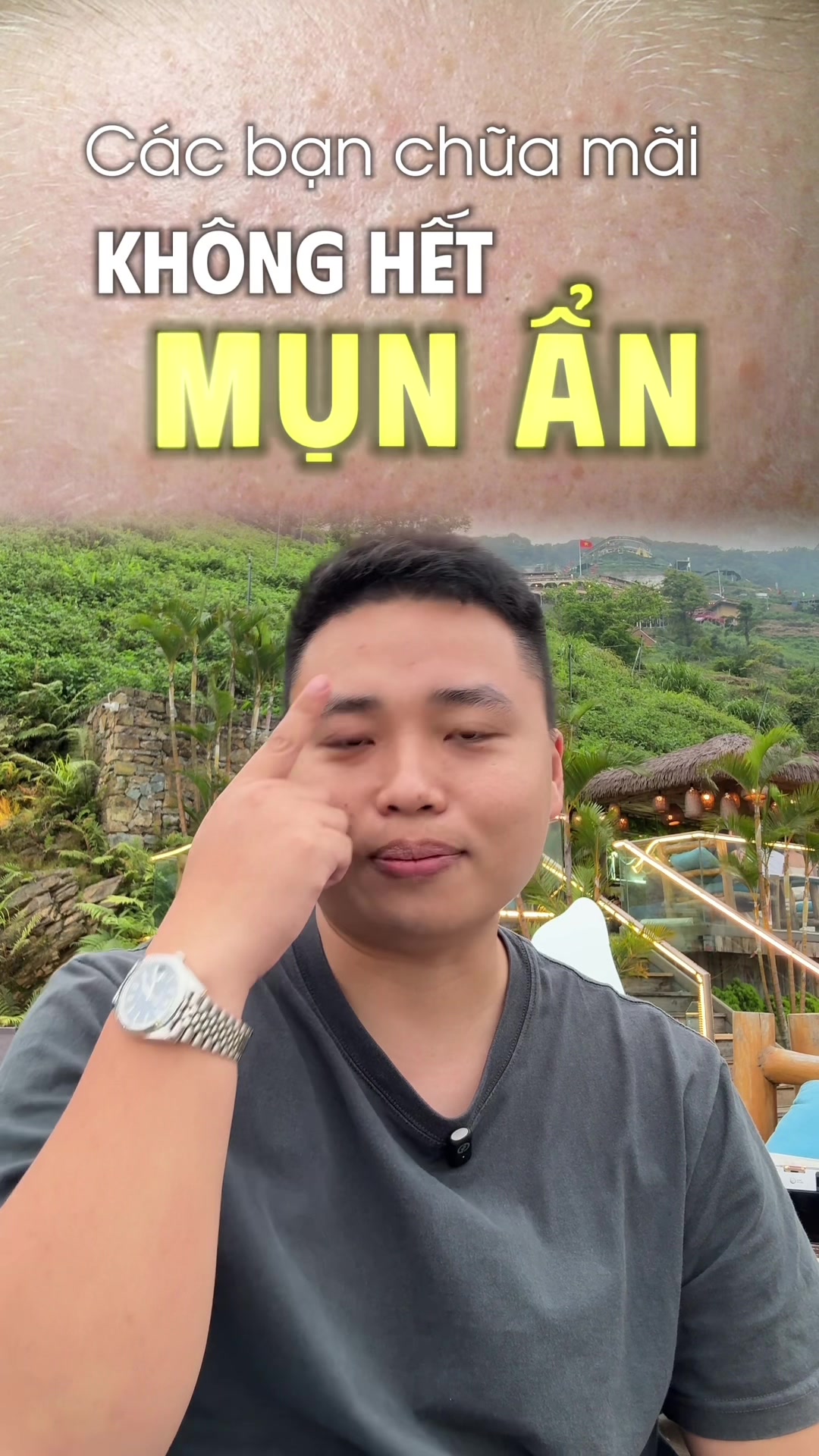 @Bác sĩ Trần Gia Khánh Da Liễu