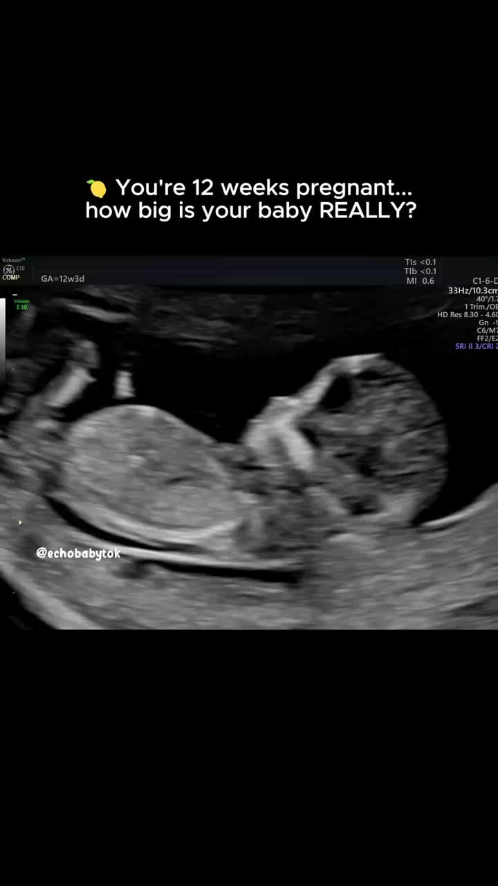 @Echobaby