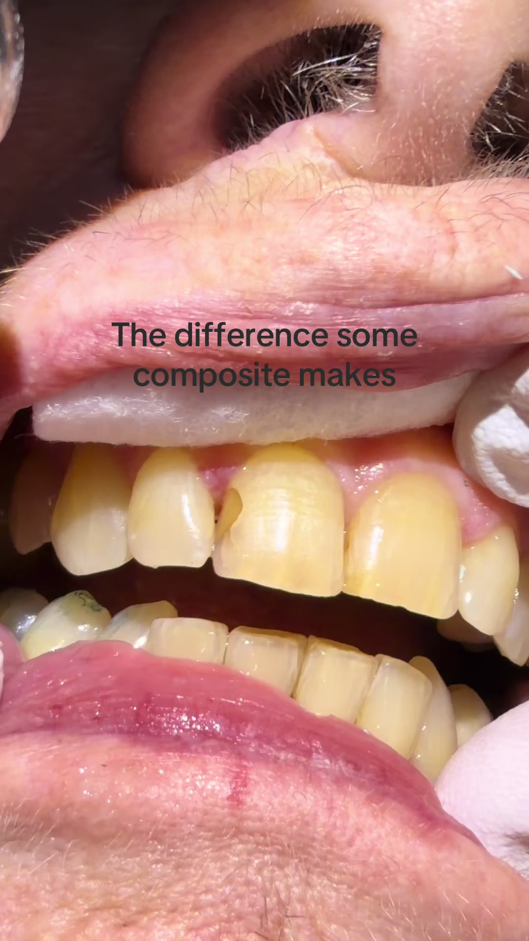 @Hello Dental
