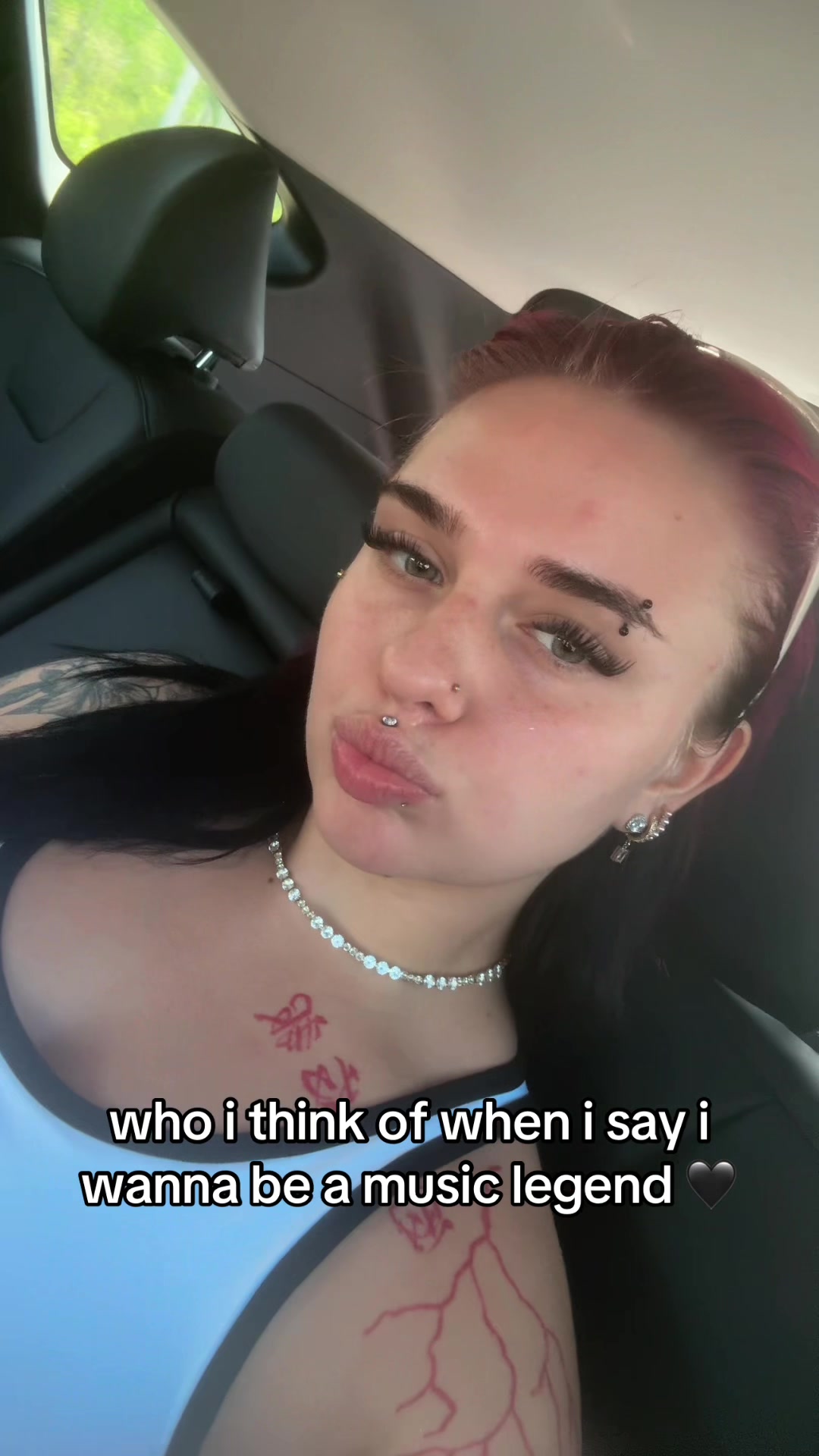 @cadi_bigct