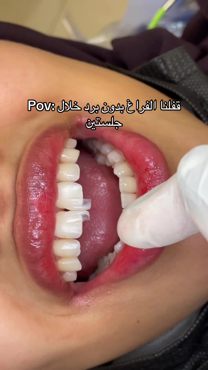 @Dr. Abrar Alhababi