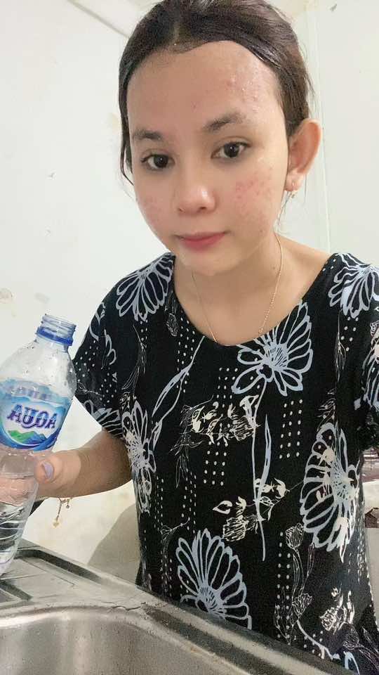 @Natha | Acne fighter
